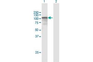 Western Blot analysis of CAST expression in transfected 293T cell line by CAST MaxPab polyclonal antibody. (Calpastatin Antikörper  (AA 1-686))