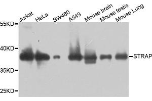 Western blot analysis of extracts of various cell lines, using STRAP antibody. (STRAP Antikörper)