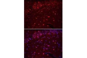 Immunofluorescence (Paraffin-embedded Sections) (IF (p)) image for anti-Ionized Calcium-binding Adapter Molecule 1 (IBA1) (AA 51-147) antibody (ABIN685477)