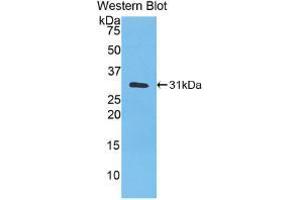 Western blot analysis of recombinant Human CA3. (CA3 Antikörper  (AA 2-260))