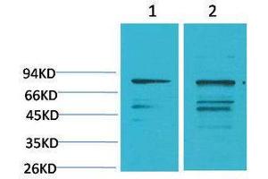 Western Blotting (WB) image for anti-Phosphoinositide 3 Kinase, p85 alpha (PI3K p85a) antibody (ABIN3179081) (PIK3R1 Antikörper)