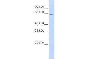 Host:  Rabbit  Target Name:  SLC25A13  Sample Type:  721_B Whole Cell lysates  Antibody Dilution:  1. (slc25a13 Antikörper  (C-Term))