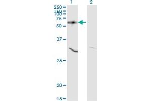 Western Blotting (WB) image for anti-V-Akt Murine Thymoma Viral Oncogene Homolog 1 (AKT1) (AA 1-481) antibody (ABIN598531) (AKT1 Antikörper  (AA 1-481))