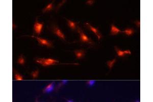 Immunofluorescence analysis of U-251MG cells using Nestin Polyclonal Antibody at dilution of 1:100 (20x lens). (Nestin Antikörper)