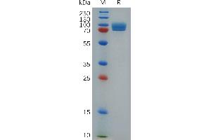 Mouse S Protein, hFc Tag on SDS-PAGE under reducing condition. (Stabilin 1 Protein (STAB1) (AA 638-1024) (Fc Tag))