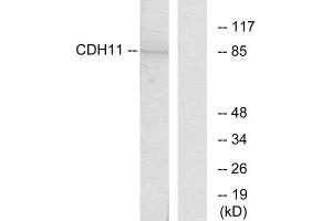Western Blotting (WB) image for anti-Cadherin 11 (CDH11) (Internal Region) antibody (ABIN1850215) (OB Cadherin Antikörper  (Internal Region))