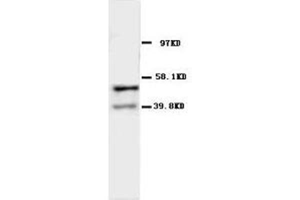 CHRNA1 Antikörper  (N-Term)