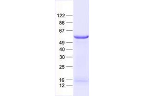 ZNF79 Protein (His tag)