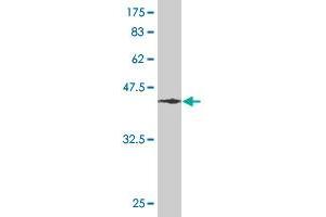 Western Blot detection against Immunogen (46. (RHOA Antikörper  (AA 1-193))