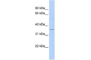 ELOVL5 antibody used at 1 ug/ml to detect target protein. (ELOVL5 Antikörper)