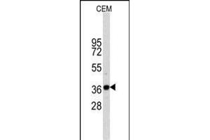 Western Blotting (WB) image for anti-Glyceraldehyde-3-Phosphate Dehydrogenase (GAPDH) antibody (ABIN1539789)