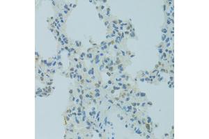 Immunohistochemistry of paraffin-embedded rat lung using MBD2 antibody (ABIN5971247) at dilution of 1/100 (40x lens). (MBD2 Antikörper)