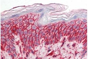 Human Skin: Formalin-Fixed, Paraffin-Embedded (FFPE) (CD44 Antikörper)