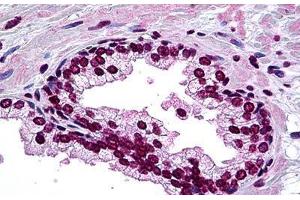Human Prostate: Formalin-Fixed, Paraffin-Embedded (FFPE) (DLX2 Antikörper  (AA 1-110))