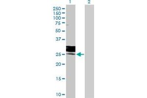 Lane 1: FOLR3 transfected lysate ( 26. (FOLR3 293T Cell Transient Overexpression Lysate(Denatured))