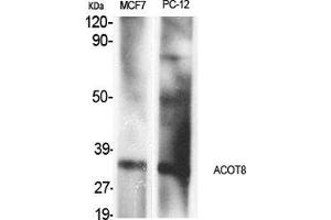 Western Blot (WB) analysis of specific cells using ACOT8 Polyclonal Antibody. (ACOT8 Antikörper  (Internal Region))