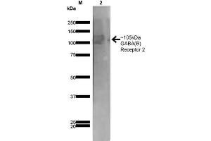 Western Blot analysis of Rat Brain Membrane showing detection of ~105 kDa GABA B Receptor 2 protein using Mouse Anti-GABA B Receptor 2 Monoclonal Antibody, Clone S81-2 . (GABBR2 Antikörper  (AA 861-912) (Biotin))