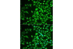 Immunofluorescence analysis of U2OS cells using LRAT antibody. (LRAT Antikörper)