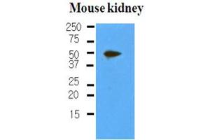 Western Blotting (WB) image for anti-Podoplanin (PDPN) antibody (ABIN306460) (Podoplanin Antikörper)