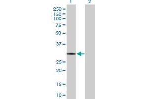 Western Blot analysis of HLA-DQA1 expression in transfected 293T cell line by HLA-DQA1 MaxPab polyclonal antibody. (HLA-DQA1 Antikörper  (AA 1-255))