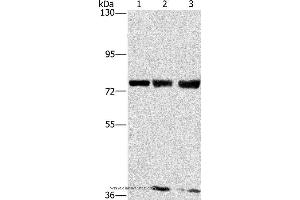 Western blot analysis of MCF7, hela and 293T cell, using GGCX Polyclonal Antibody at dilution of 1:400 (GGCX Antikörper)