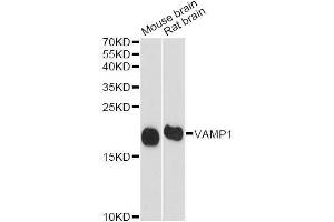 Western blot analysis of extracts of various cell lines, using VAMP1 antibody (ABIN5995694) at 1/1000 dilution. (VAMP1 Antikörper)
