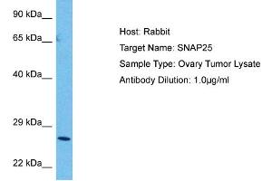 Host:  Rabbit  Target Name:  SNAP25  Sample Tissue:  Human Ovary Tumor  Antibody Dilution:  1ug/ml (SNAP25 Antikörper  (C-Term))