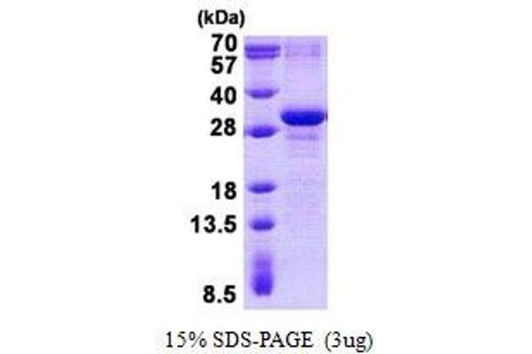 MXD3 Protein (His tag)