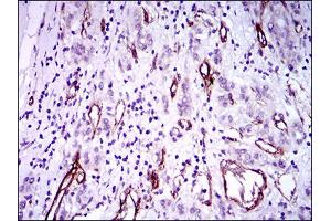 Immunohistochemistry (IHC) image for anti-Goosecoid Homeobox (GSC) (AA 191-257) antibody (ABIN1724843)