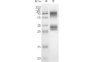 WB analysis of Human OR3A1-Nanodisc with anti-Flag monoclonal antibody at 1/5000 dilution, followed by Goat Anti-Rabbit IgG HRP at 1/5000 dilution (OR3A1 Protein)