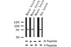 Western blot analysis of Phospho-LIMK1/2 (Thr508/505) expression in various lysates (LIMK-1/2 (pThr505), (pThr508) Antikörper)