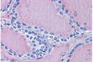 Human Thyroid: Formalin-Fixed, Paraffin-Embedded (FFPE) (Thyroglobulin Antikörper)