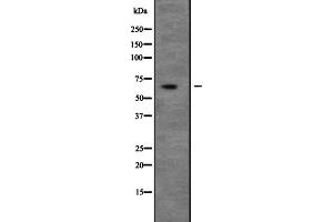 Western blot analysis of UNC5C expression in 293T whole cell lysate ,The lane on the left is treated with the antigen-specific peptide. (Unc5c Antikörper  (N-Term))