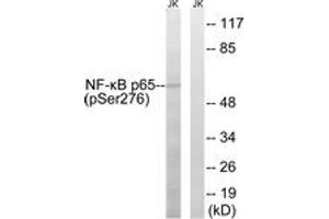 Western Blotting (WB) image for anti-Nuclear Factor-kB p65 (NFkBP65) (pSer276) antibody (ABIN2888487) (NF-kB p65 Antikörper  (pSer276))