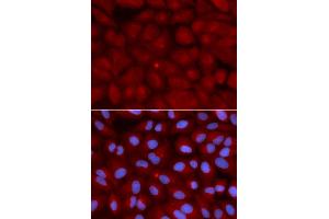Immunofluorescence analysis of U2OS cells using BIN1 antibody. (BIN1 Antikörper)