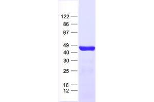 Validation with Western Blot (ARFIP1 Protein (His tag))