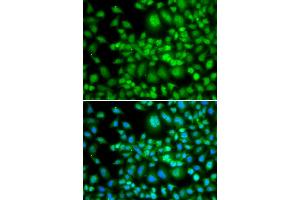 Immunofluorescence analysis of MCF-7 cells using SETD5 antibody (ABIN5974406). (SETD5 Antikörper)