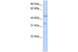 RDHE2 antibody used at 1 ug/ml to detect target protein. (SDR16C5 Antikörper  (Middle Region))