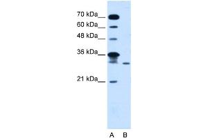 WB Suggested Anti-GLTPD2 Antibody Titration:  5. (GLTPD2 Antikörper  (Middle Region))