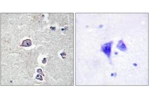 Immunohistochemistry (IHC) image for anti-Platelet Derived Growth Factor Receptor alpha (PDGFRA) (AA 721-770) antibody (ABIN2888854) (PDGFRA Antikörper  (AA 721-770))