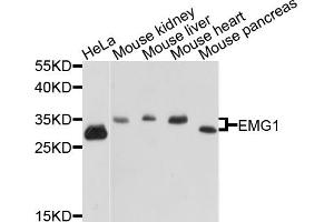 Western blot analysis of extracts of various cell lines, using EMG1 antibody (ABIN5972482) at 1/1000 dilution. (EMG1 Antikörper)