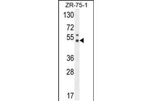 Western blot analysis in ZR-75-1 cell line lysates (35ug/lane). (PUS3 Antikörper  (N-Term))