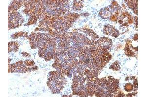 Image no. 1 for anti-Parathyroid Hormone (PTH) (C-Term) antibody (ABIN6166676) (PTH Antikörper  (C-Term))