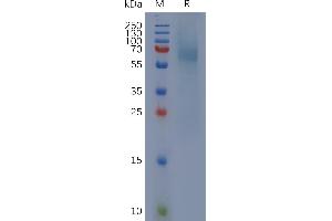 Cynomolgus IgHE Protein, His Tag on SDS-PAGE under reducing condition. (IgE Protein (AA 1-432) (His tag))