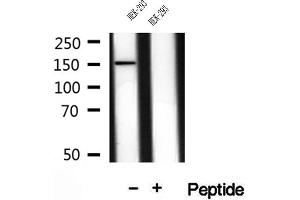 Western blot analysis of extracts of HEK-293 cells, using VPRBP antibody. (VPRBP Antikörper)