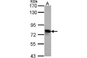 WB Image Sample (30 ug of whole cell lysate) A: Hela 7. (TGFBI Antikörper)