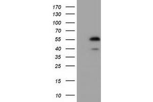 Western Blotting (WB) image for anti-Epoxide Hydrolase 2, Cytoplasmic (EPHX2) antibody (ABIN1500857) (EPHX2 Antikörper)