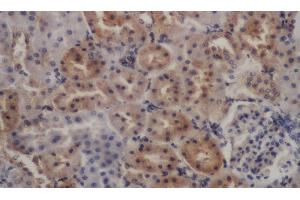 Immunohistochemistry of paraffin-embedded Rat kidney using PDGFRB Polyclonal Antibody at dilution of 1:50 (PDGFRB Antikörper)