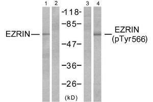 Western blot analysis of extracts from A431 cells, untreated or EGF-treated (200ng/ml, 30min) using Ezrin (Ab-566) antibody (E021200, Lane 1 and 2) and Ezrin (phospho-Thr566) antibody (E011202, Lane 3 and 4). (Ezrin Antikörper)