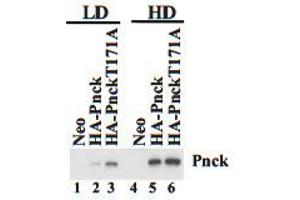 Neo, HA-Pnck and HA-Pnck T171A HEK-293 cells were plated at low (LD) and high (HD) cell density and lysates prepared after 48 hours. (PNCK Antikörper  (C-Term))